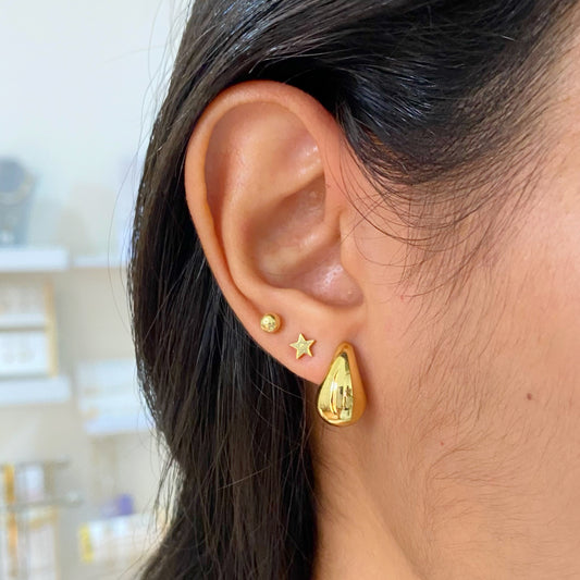 aretes (1528)